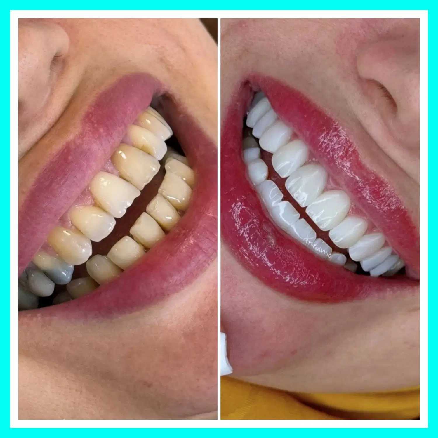 دندانپزشکی/کامپوزیت/ترمیم/عصبکشی ایمپلنت شرق و غرب|خدمات زیبایی و سلامت|تهران, تهرانپارس شرقی|دیوار