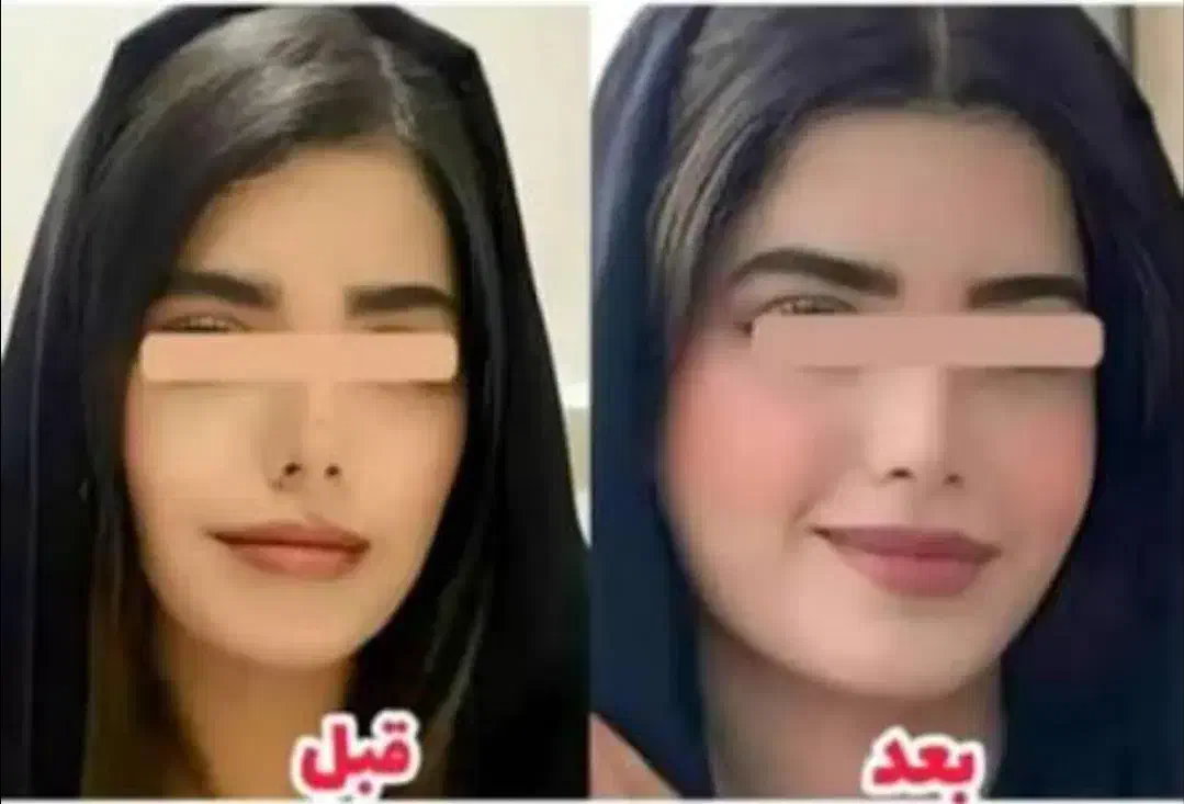 چاقی بدن و صورت|آرایشی، بهداشتی، درمانی|کرمان, |دیوار