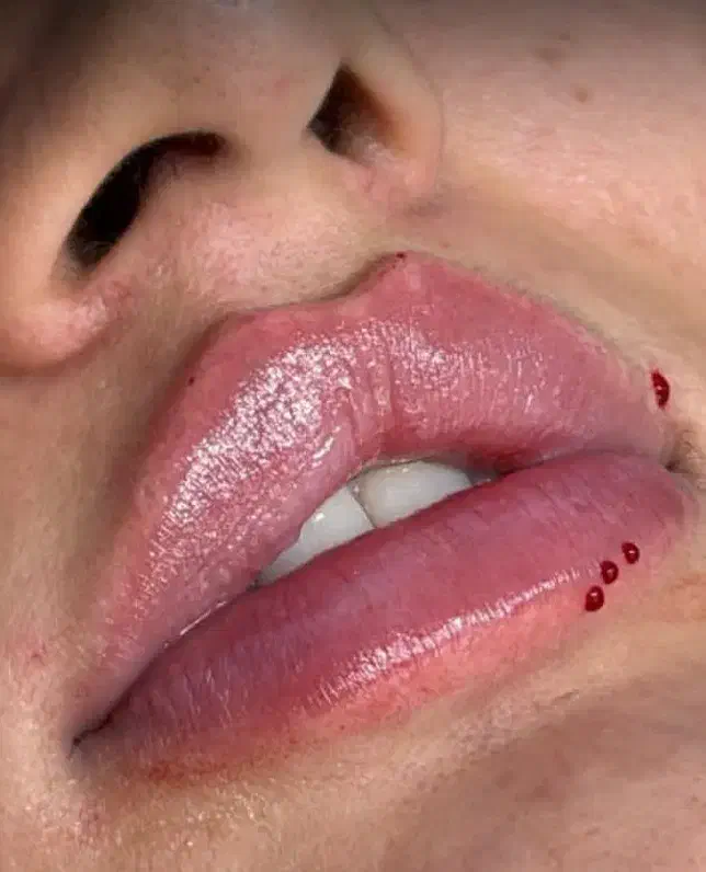 آف ژل و بوتاکس پردیس|خدمات آرایشگری و زیبایی|اهواز, پردیس|دیوار