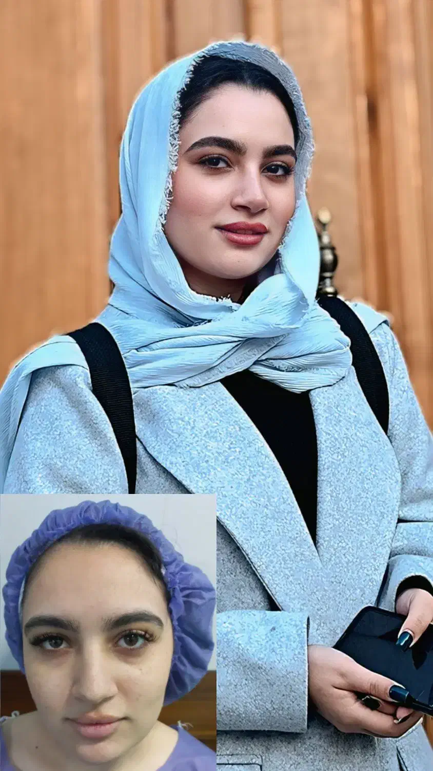 جشنواره تخفیف عمل زیبایی بینی|خدمات آرایشگری و زیبایی|قائم‌شهر, |دیوار