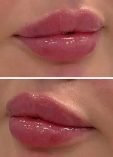 ژل و بوتاکس/ ژل لب/کانتورینگ عربی/روسی|خدمات آرایشگری و زیبایی|فردیس, فردیس|دیوار