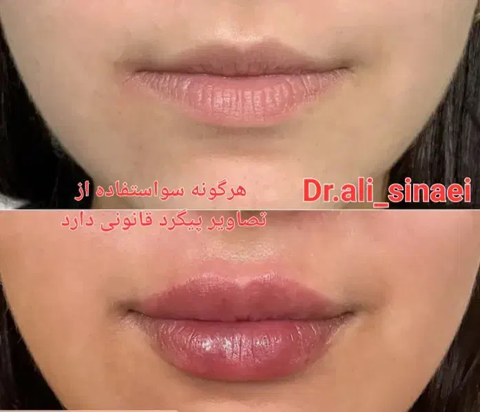 جشنواره تزریق فیلر و ژل و بوتاکس در قلب پزشکی مشهد|خدمات آرایشگری و زیبایی|مشهد, احمدآباد|دیوار