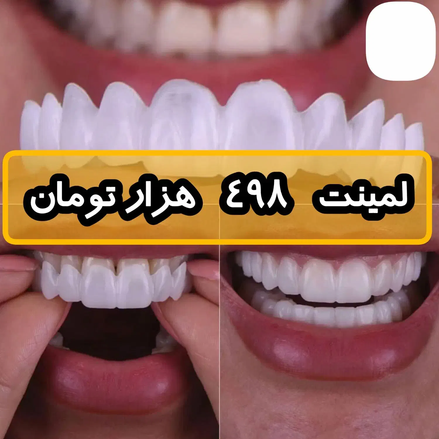 لیمات اس لارج FT|تخت و صندلی بچه|احمدی, |دیوار