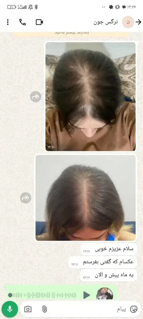 تقویت کننده مو|آرایشی، بهداشتی، درمانی|کاشمر, |دیوار