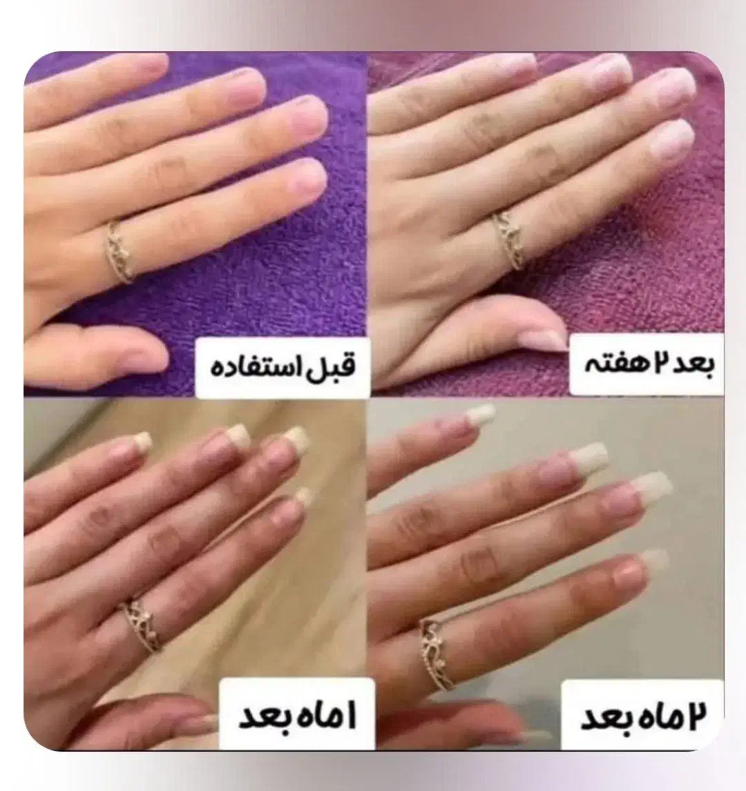 لوسیون و سرم دوفاز ناخن ویتابلا|آرایشی، بهداشتی، درمانی|زاهدان, |دیوار