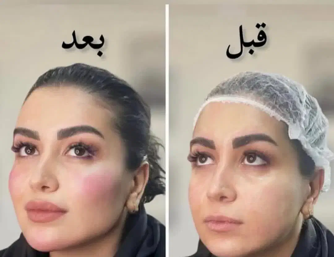 ژل لب فقط ۳۸۰|خدمات آرایشگری و زیبایی|شیراز, شهرک فرهنگیان|دیوار