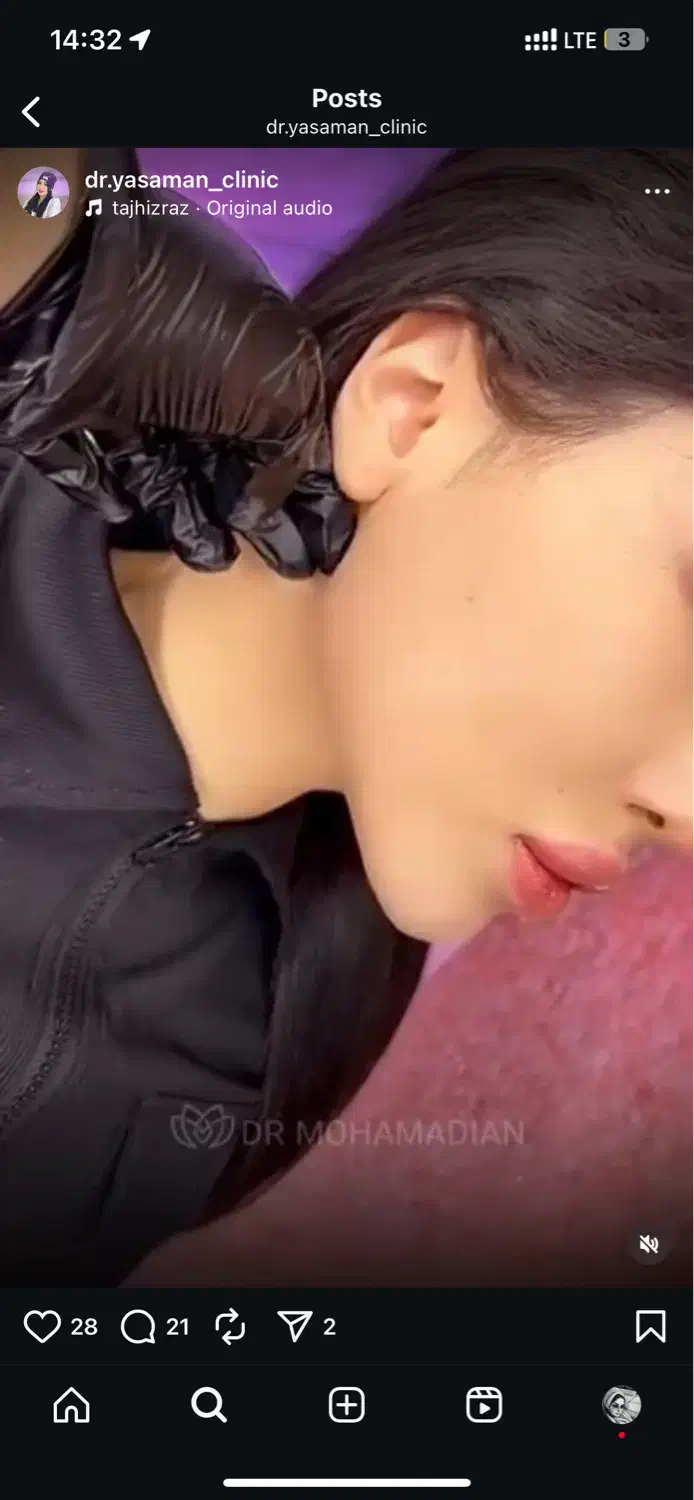 جشنواره فول فیس توسط پزشک متخصص|خدمات آرایشگری و زیبایی|تهران, ونک|دیوار