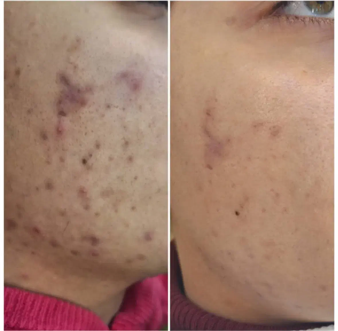 فیشیال تخصصی ویژه روز مادر و زن با بهترین قیمت|خدمات آرایشگری و زیبایی|شاهرود, |دیوار