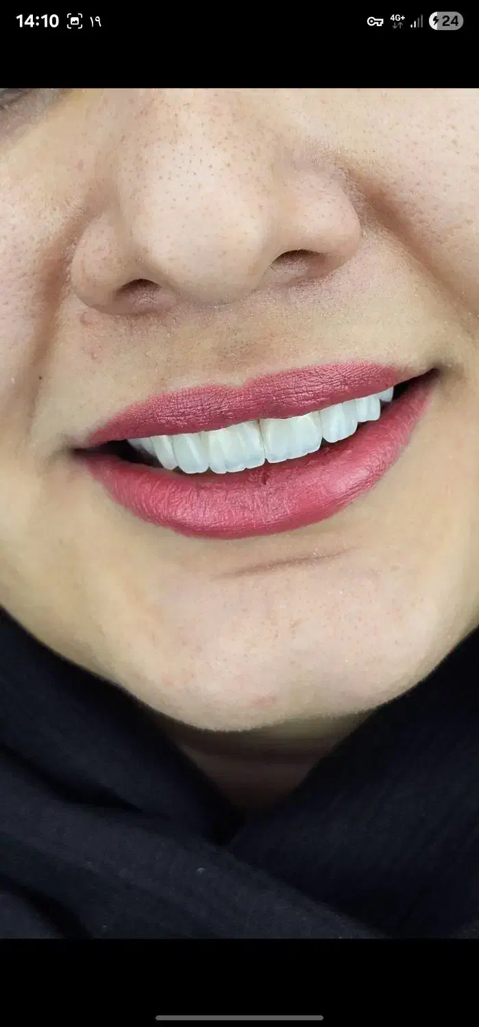 مطب دندانپزشکی طرف قرارداد با بیمه های تکمیلی|خدمات آرایشگری و زیبایی|قزوین, |دیوار