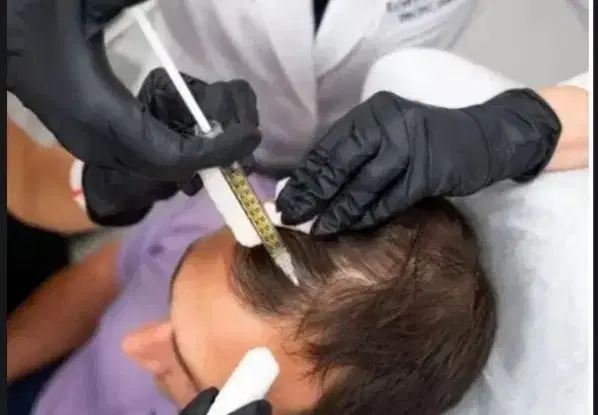 پی آر پی حجامت بادکش گرم فصد خون زالو مزاج شناسی|خدمات زیبایی و سلامت|تهران, مجیدیه|دیوار