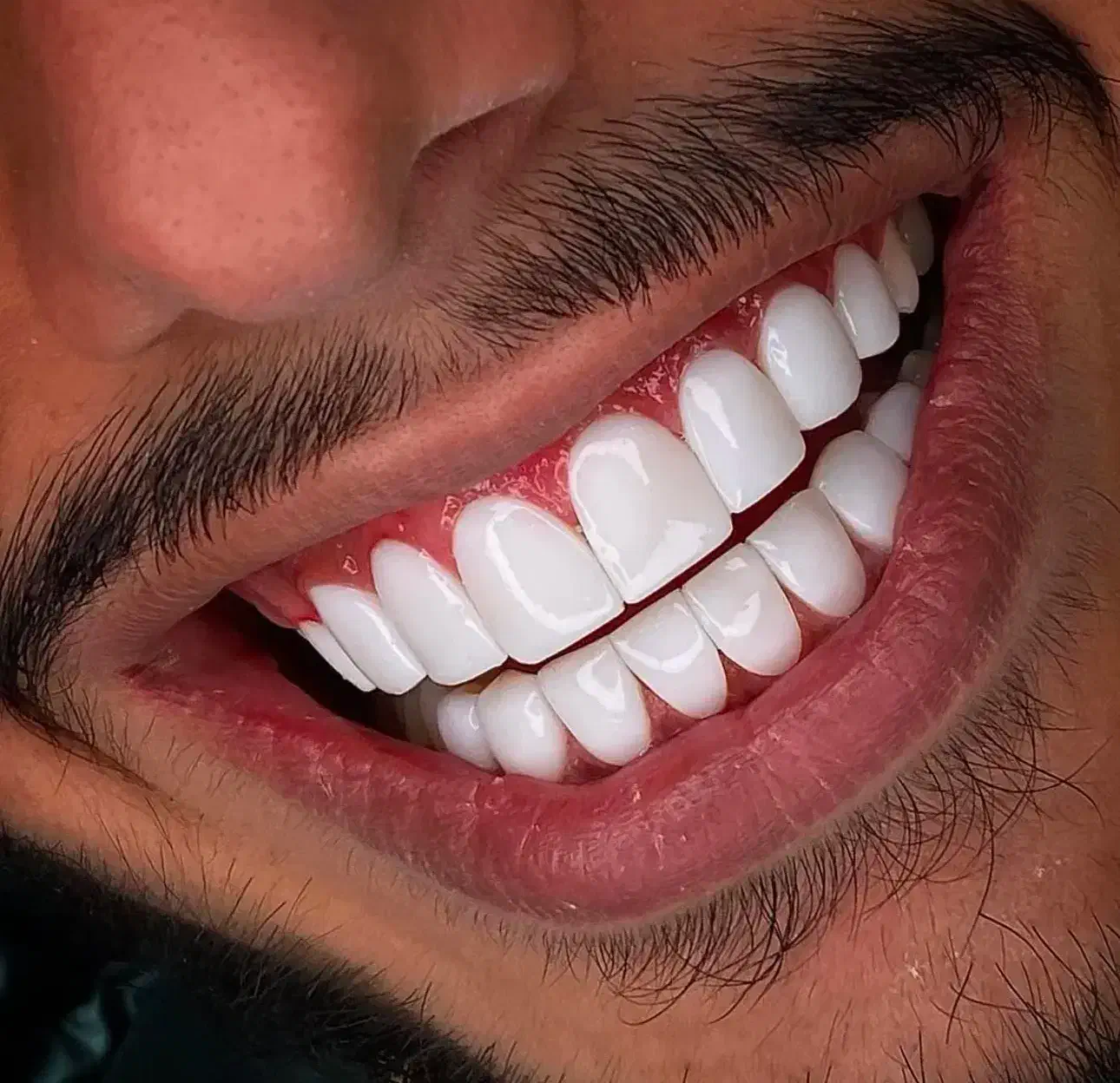 منشی خانوم جهت همکاری|استخدام درمانی، زیبایی، بهداشتی|فردیس, فردیس|دیوار