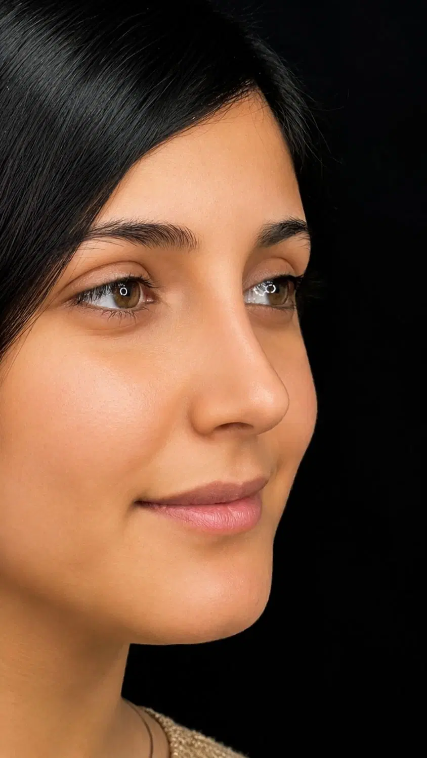 عمل بینی با. شرایط اقساطی با چک صیادی|خدمات زیبایی و سلامت|تهران, اقدسیه|دیوار