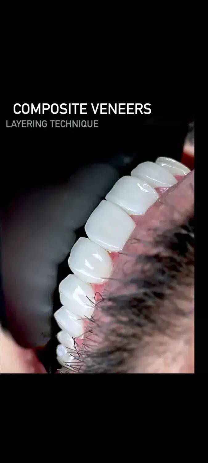 دندانپزشکی بهبهان// پرداخت بدون پیش و بیمه تکمیلی|خدمات آرایشگری و زیبایی|دیلم, |دیوار