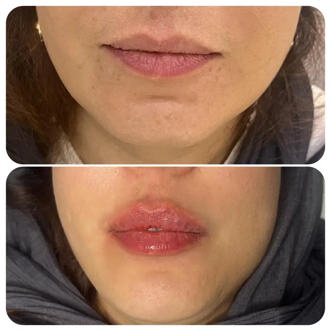 ۷۰درصد تخفیف بلک فرایدی|خدمات آرایشگری و زیبایی|اصفهان, سرچشمه|دیوار