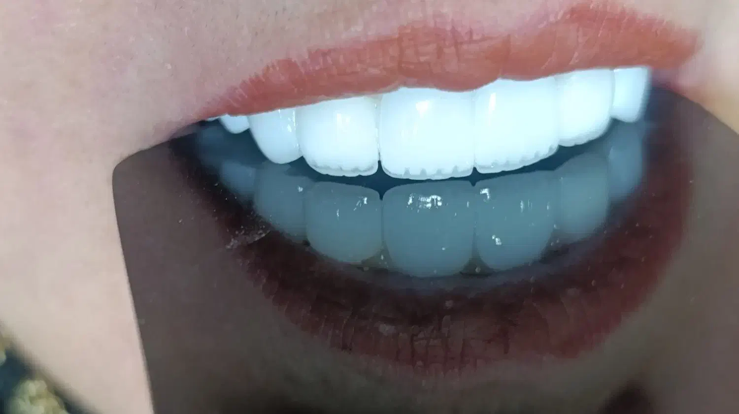 دندانپزشکی بیمه تامین اجتماعی کمیته امدادوبهزیستی|خدمات آرایشگری و زیبایی|نورآباد, |دیوار