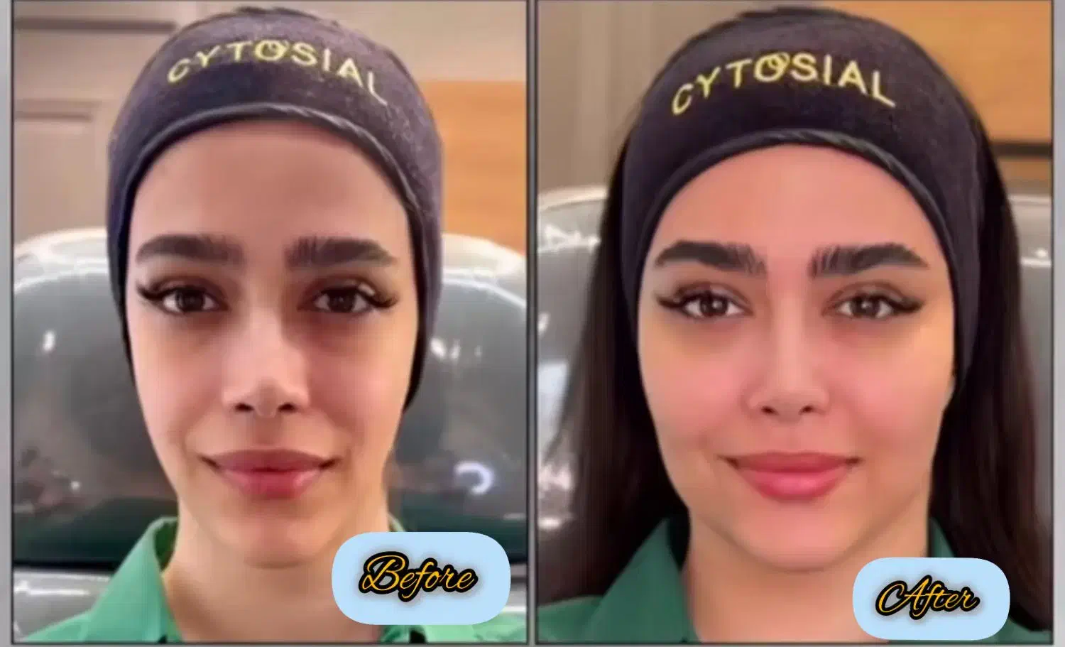 خدمات تخصصی فیلر و بوتاکس ومزوتراپی|خدمات آرایشگری و زیبایی|شاهینشهر, فردوسی|دیوار