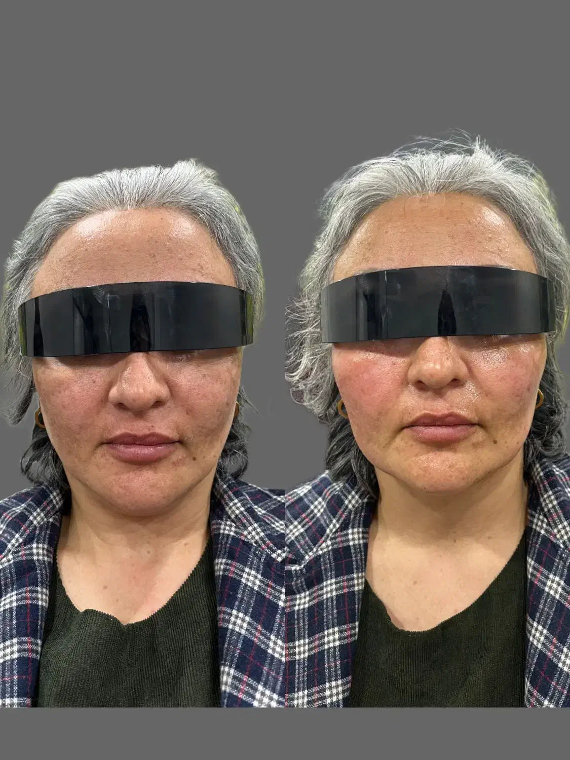 زیبا سازی|خدمات آرایشگری و زیبایی|سقز, |دیوار