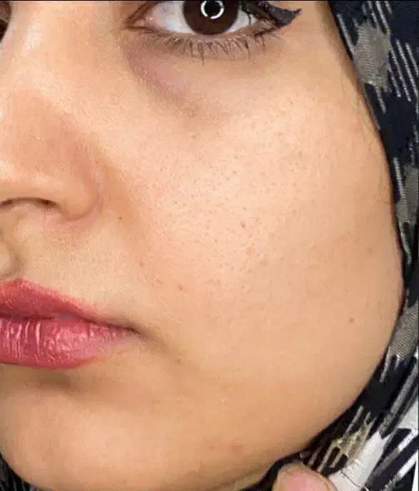 درمان ریزش مو و لک پوستی با محصولات اصل تراست|آرایشی، بهداشتی، درمانی|قدس, شهر‌قدس|دیوار
