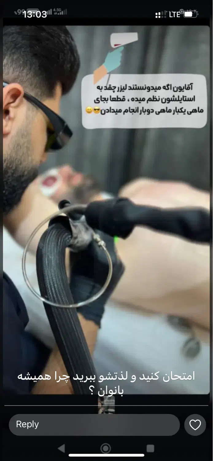 جشنواره لیزر موهای زائد الکساندرایت دکا ۲۰۲۵|خدمات آرایشگری و زیبایی|اصفهان, عسگریه|دیوار