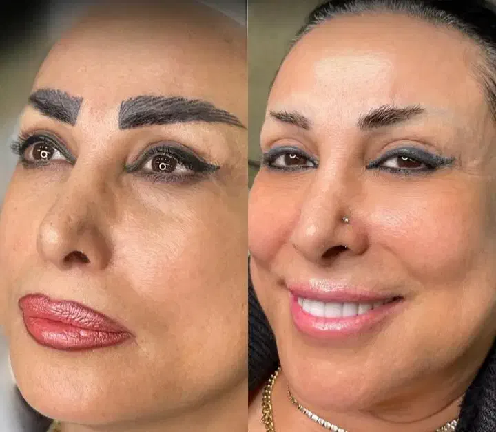 مدل برای ریمو تک جلسه ای تتو قدیمی|خدمات آرایشگری و زیبایی|نوشهر, |دیوار