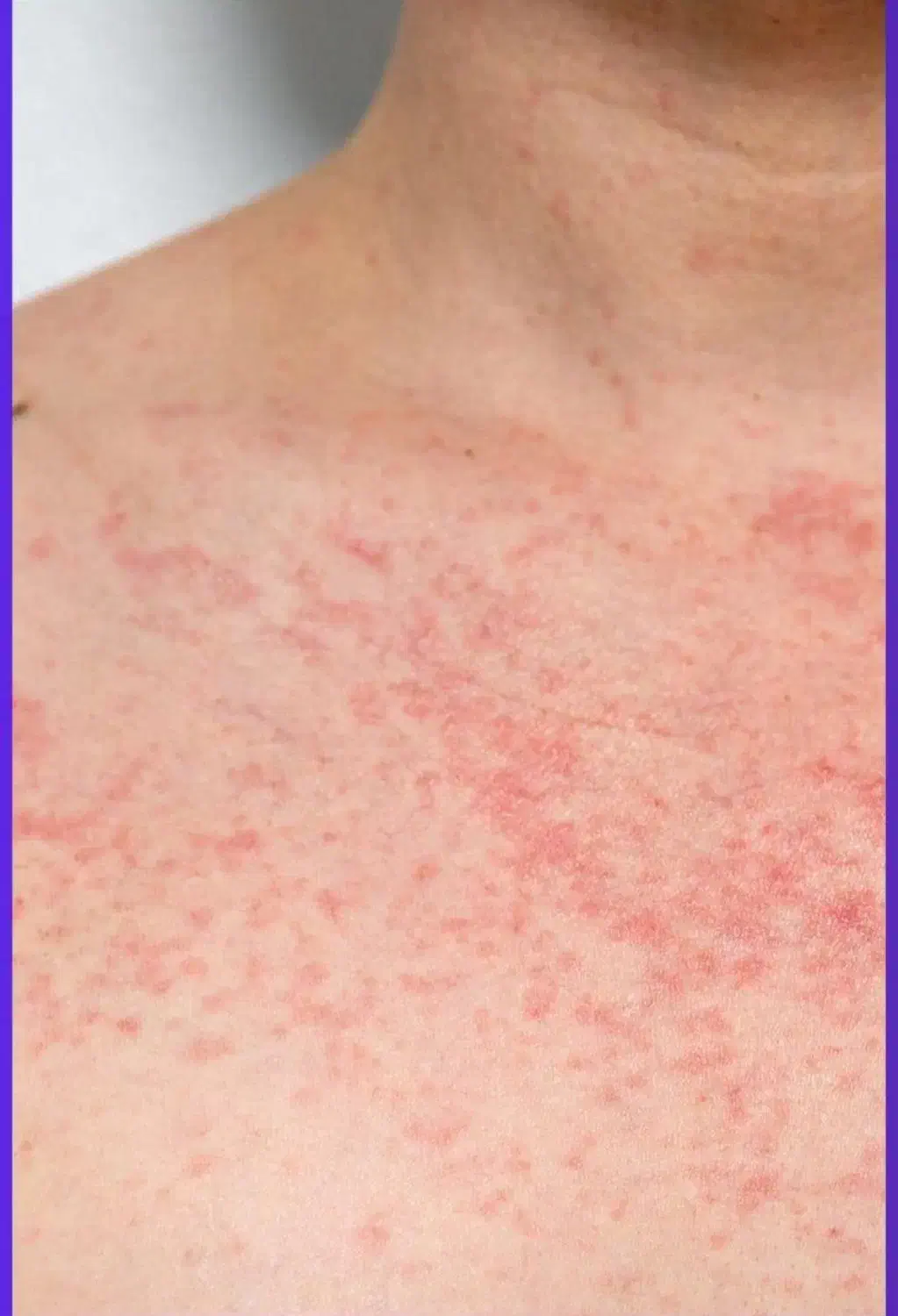 مشاوره تخصصی ویروسهای خاص بدن (مشاوره محرمانه)|آرایشی، بهداشتی، درمانی|گنبد کاووس, |دیوار