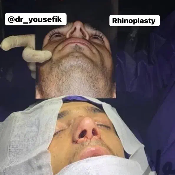 جشنواره ویژه جراحی بینی رینوپلاستی قیمت استثنایی|خدمات آرایشگری و زیبایی|جوانرود, |دیوار