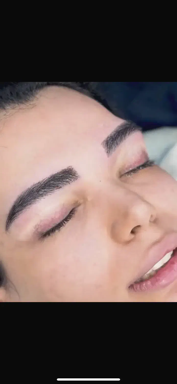 فیلر سی سی۳۳۰ بلفاروپلاستی ۶/۹۰۰ بوتاکس ۲۵۰|خدمات آرایشگری و زیبایی|تهران, صادقیه|دیوار