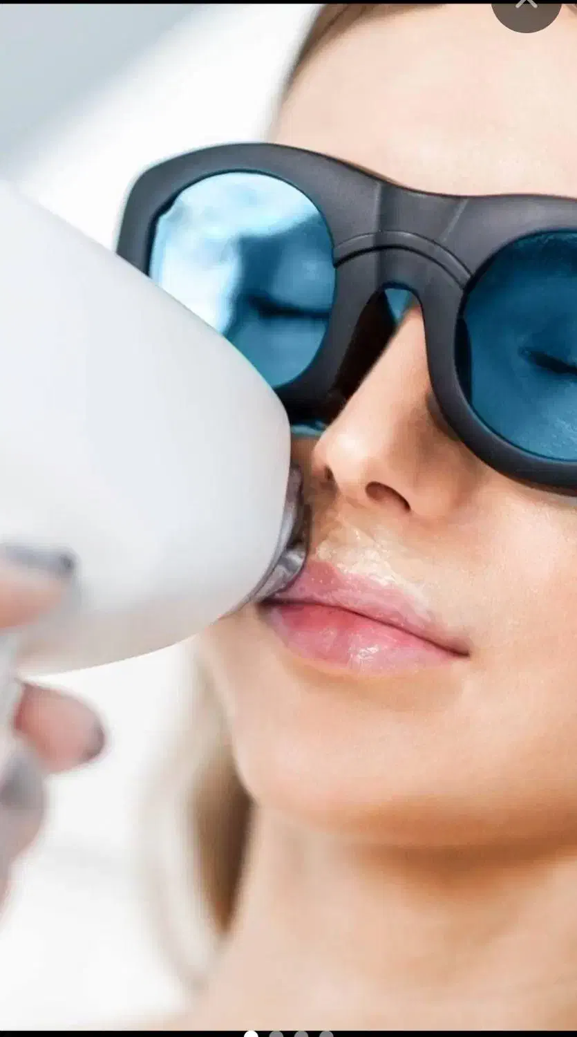 جشنواره پاییزی لیزر با دستگاه کندلا آمریکایی ۲۰۲۴|خدمات آرایشگری و زیبایی|اصفهان, سعادتآباد|دیوار