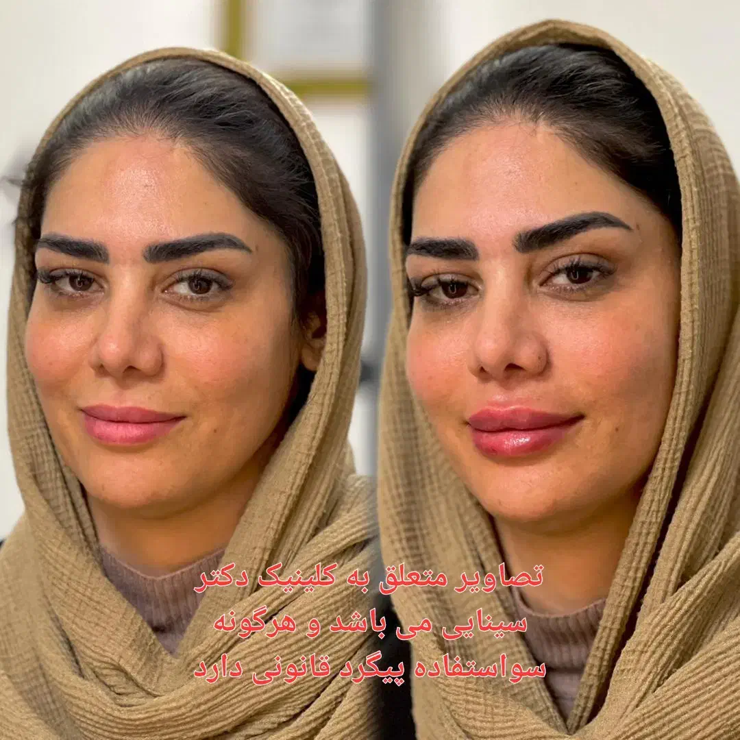 تزریق ژل و بوتاکس و لیزر در مطمئن ترین کلینیک مشهد|خدمات آرایشگری و زیبایی|مشهد, احمدآباد|دیوار