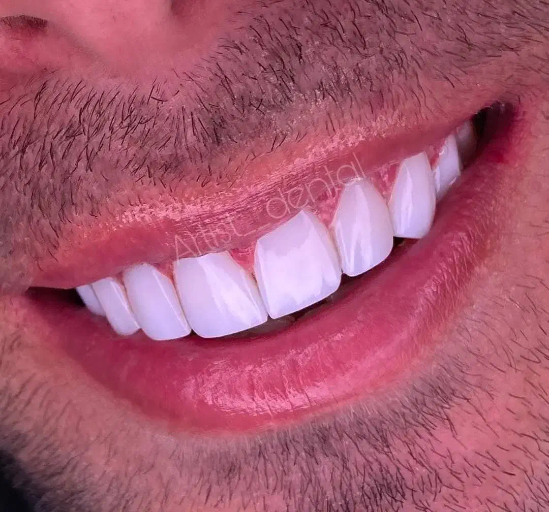 دندانپزشکی و ایمپلنت و کامپوزیت و ارتودنسی|خدمات آرایشگری و زیبایی|سرپل ذهاب, |دیوار