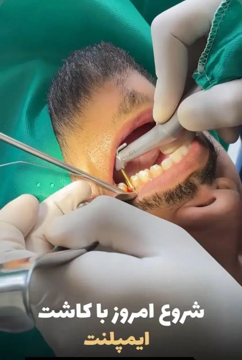 دندانپزشکی اقساطی بدون بهره|خدمات آرایشگری و زیبایی|کرج, کوی کارمندان شمالی|دیوار