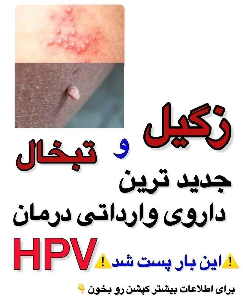 رفع زگیل|خدمات آرایشگری و زیبایی|رشت, بوسار|دیوار