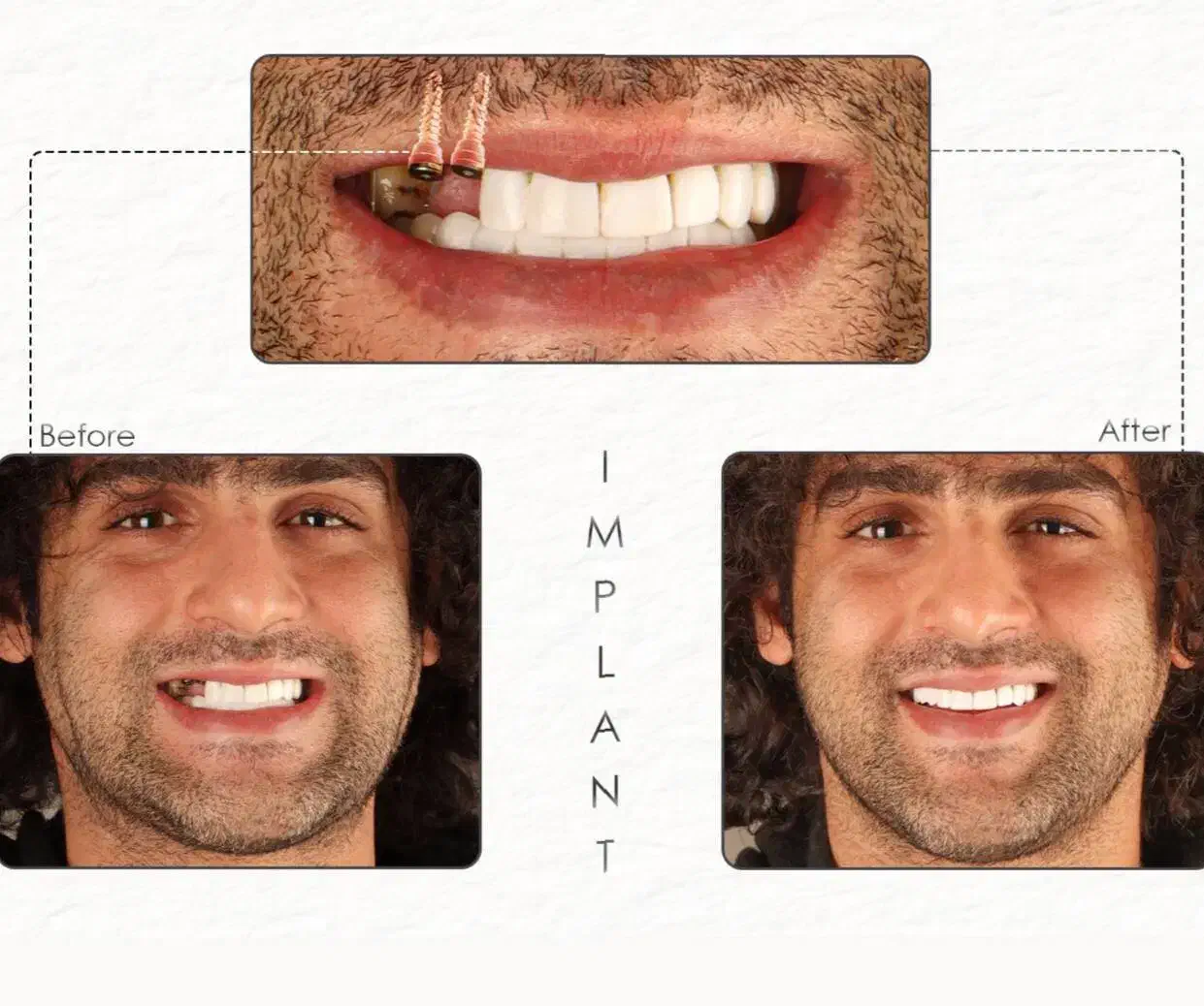 صفرتاصد خدمات دندانپزشکی به صورت اقساطی|خدمات آرایشگری و زیبایی|بوشهر, |دیوار