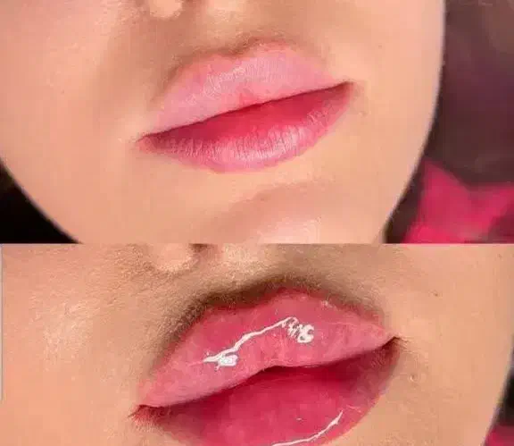 آفر ویژه خدمات زیبایی ژل فیلر بوتاکس لیفت|خدمات آرایشگری و زیبایی|شاهینشهر, طالقانی|دیوار