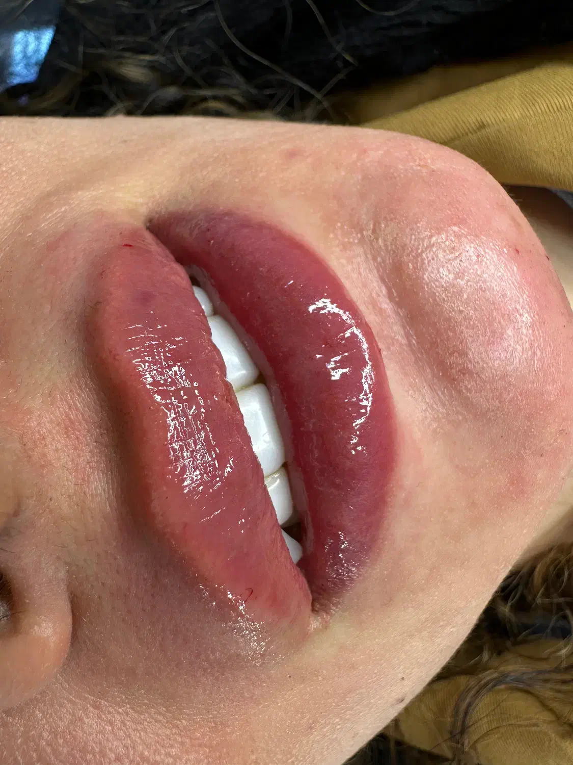 تزریق و آموزش ژل و بوتاکس|خدمات آرایشگری و زیبایی|تهران, مسعودیه|دیوار