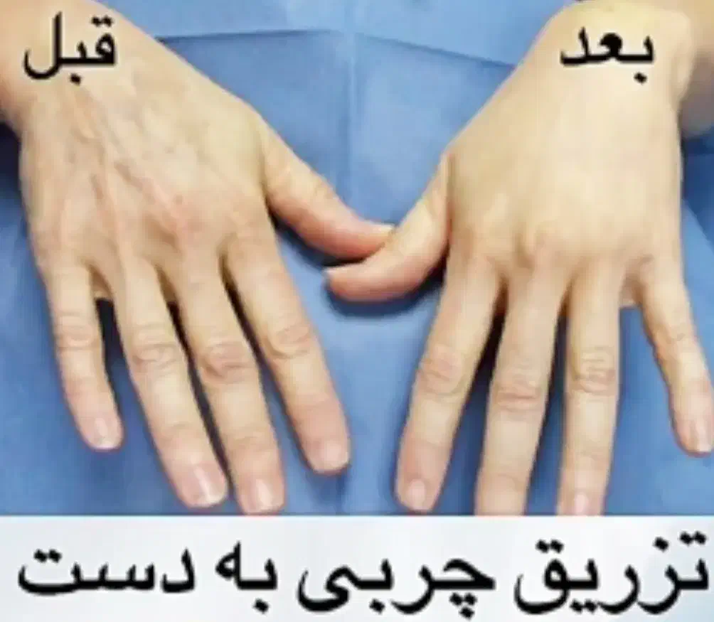 مطب جراح|خدمات آرایشگری و زیبایی|بهبهان, |دیوار