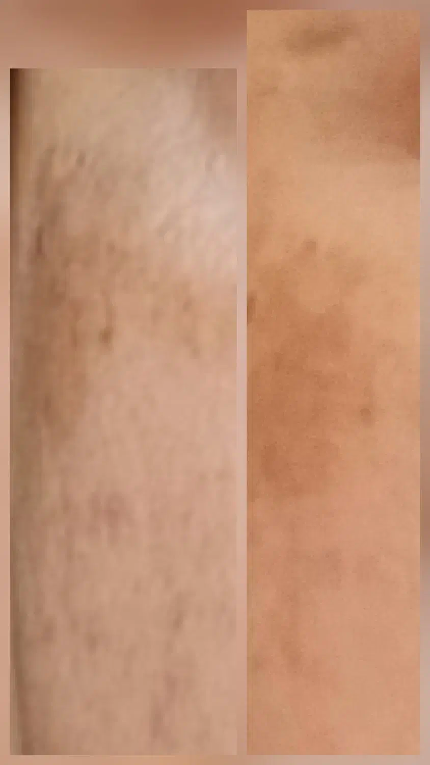 محصولات لدورا|آرایشی، بهداشتی، درمانی|چابکسر, |دیوار