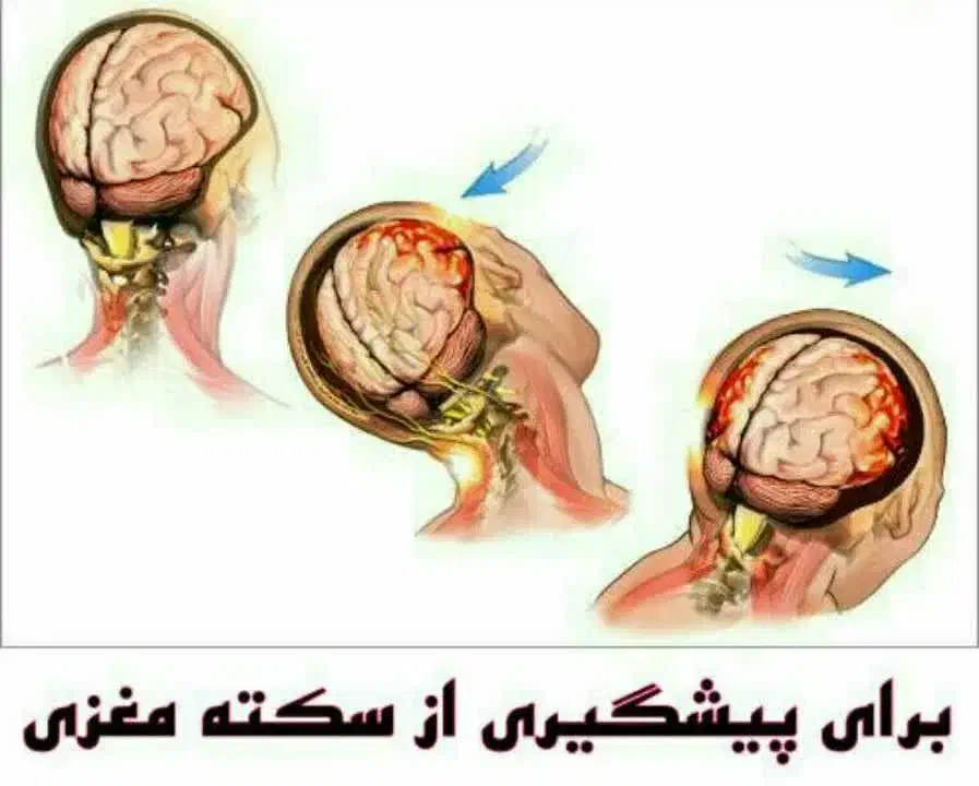 با خیال راحت فشار خون و چربی خون را کاهش بده|آرایشی، بهداشتی، درمانی|تربت‌حیدریه, سیلوی گندم|دیوار