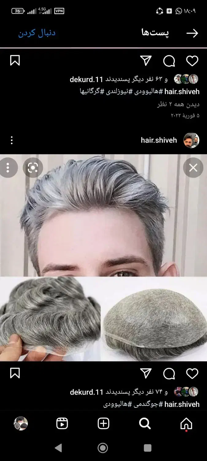 پروتز مو بافت مو ترمیم مو سجادی ارزانتر از همه جا|خدمات آرایشگری و زیبایی|تهران, جوادیه تهرانپارس|دیوار