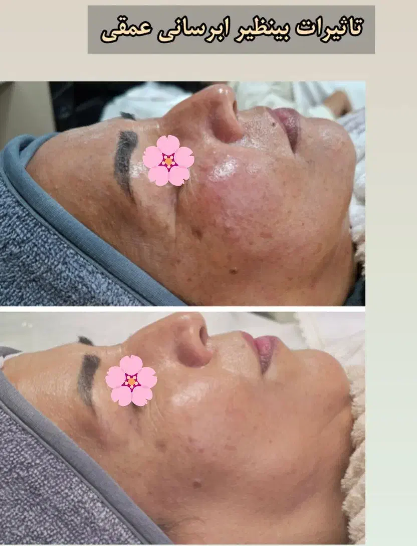 فیشال ویژه مادرانه|خدمات آرایشگری و زیبایی|نجف‌آباد, الله اکبر|دیوار