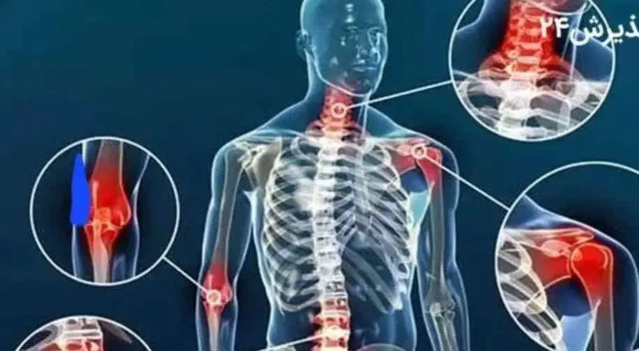 آموزش طب فیزیک (ماساژ درمانی کایروپراکتیک)|خدمات آموزشی|قم, چهل درخت|دیوار