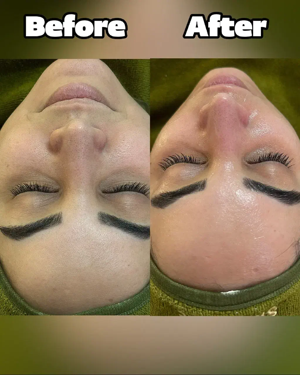 فیشال فیشیال فشیال پاکسازی پاکسازی صورت|خدمات آرایشگری و زیبایی|قم, انسجام|دیوار