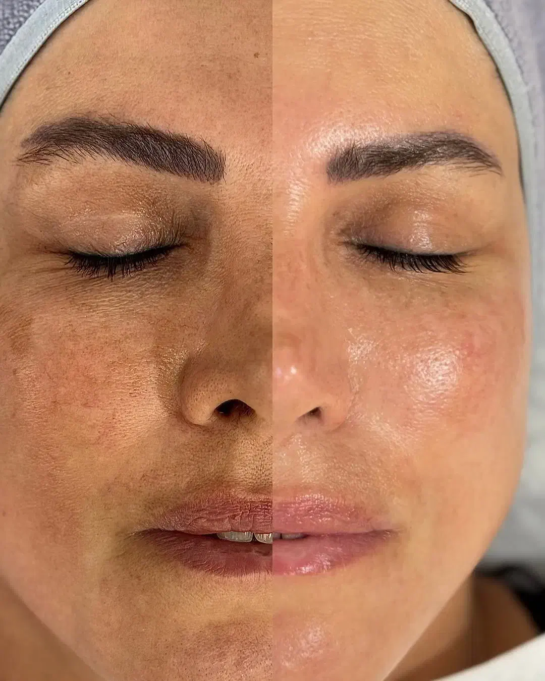 پاکسازی پوست وفیشیال|خدمات آرایشگری و زیبایی|مسجد سلیمان, |دیوار