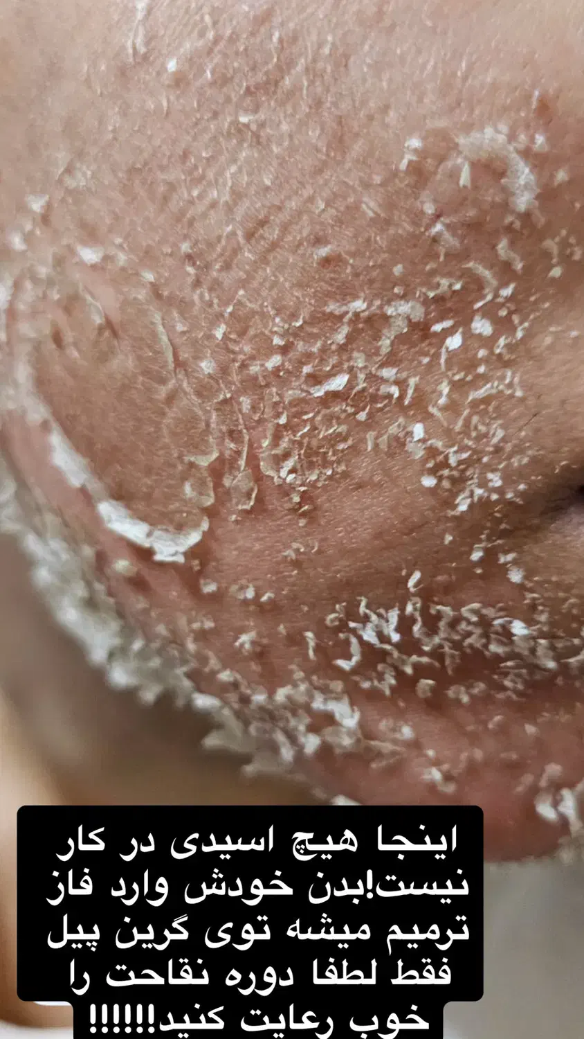 پوست روشن را از ما بخواهید|خدمات آرایشگری و زیبایی|رشت, گلسار|دیوار