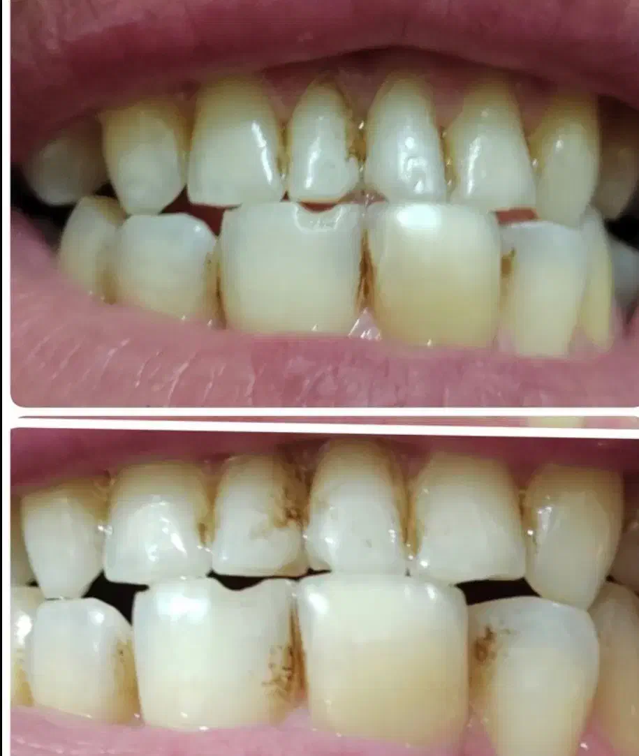 خمیر جرمگیر دندان کیمیا|آرایشی، بهداشتی، درمانی|قم, پردیسان|دیوار