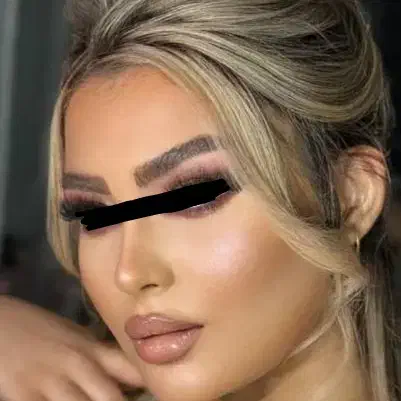 عمل بینی|خدمات آرایشگری و زیبایی|خرم‌آباد, |دیوار