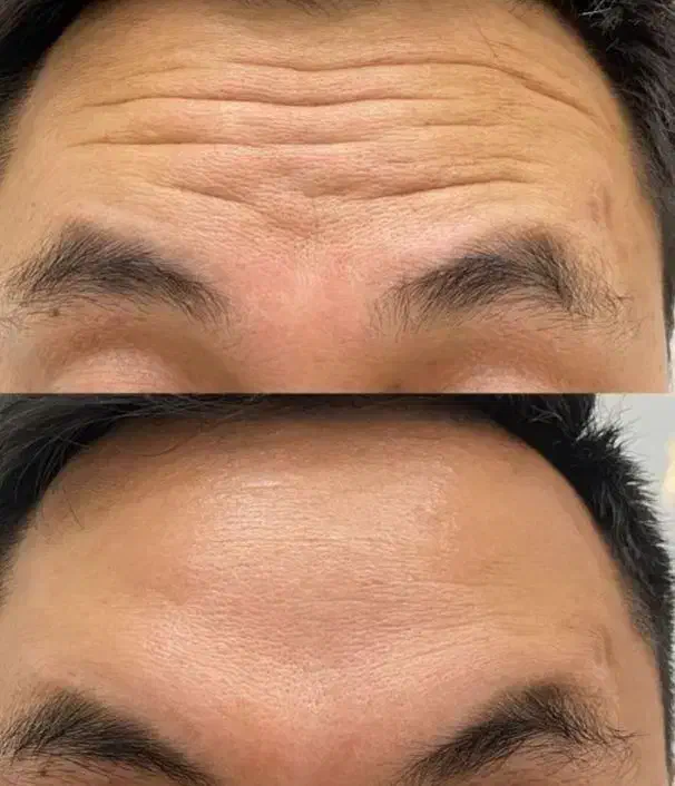 کامپوزیت دندان لیزرمو ژل بوتاکس فیلر مزو پی ارپی|خدمات آرایشگری و زیبایی|اسلامشهر, زرافشان|دیوار