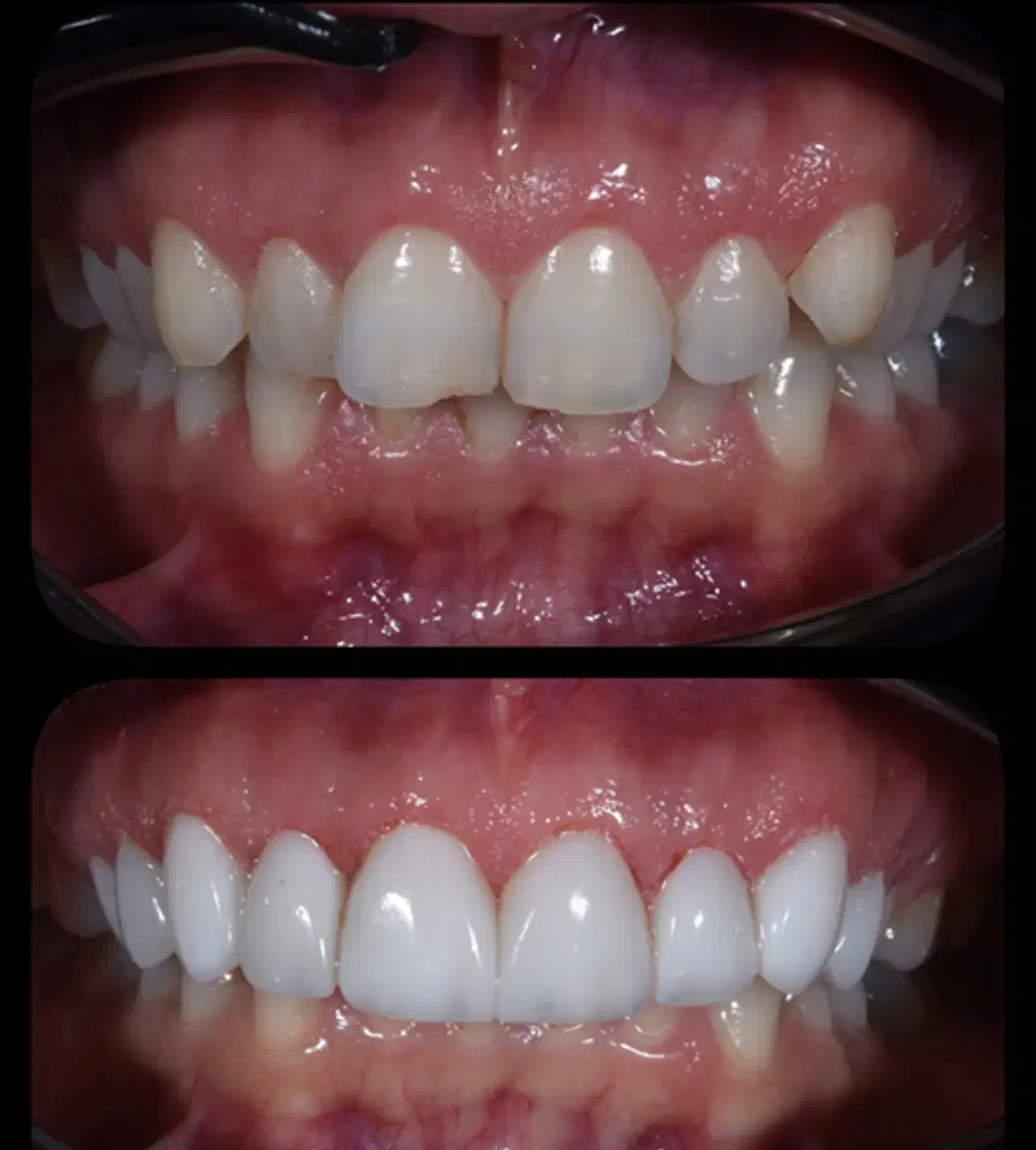 جشنواره کامپوزیت،لمینیت وبلیچینگ وخدمات دندانپزشکی|خدمات آرایشگری و زیبایی|شاهین‌شهر, مخابرات (شهید بهشتی)|دیوار