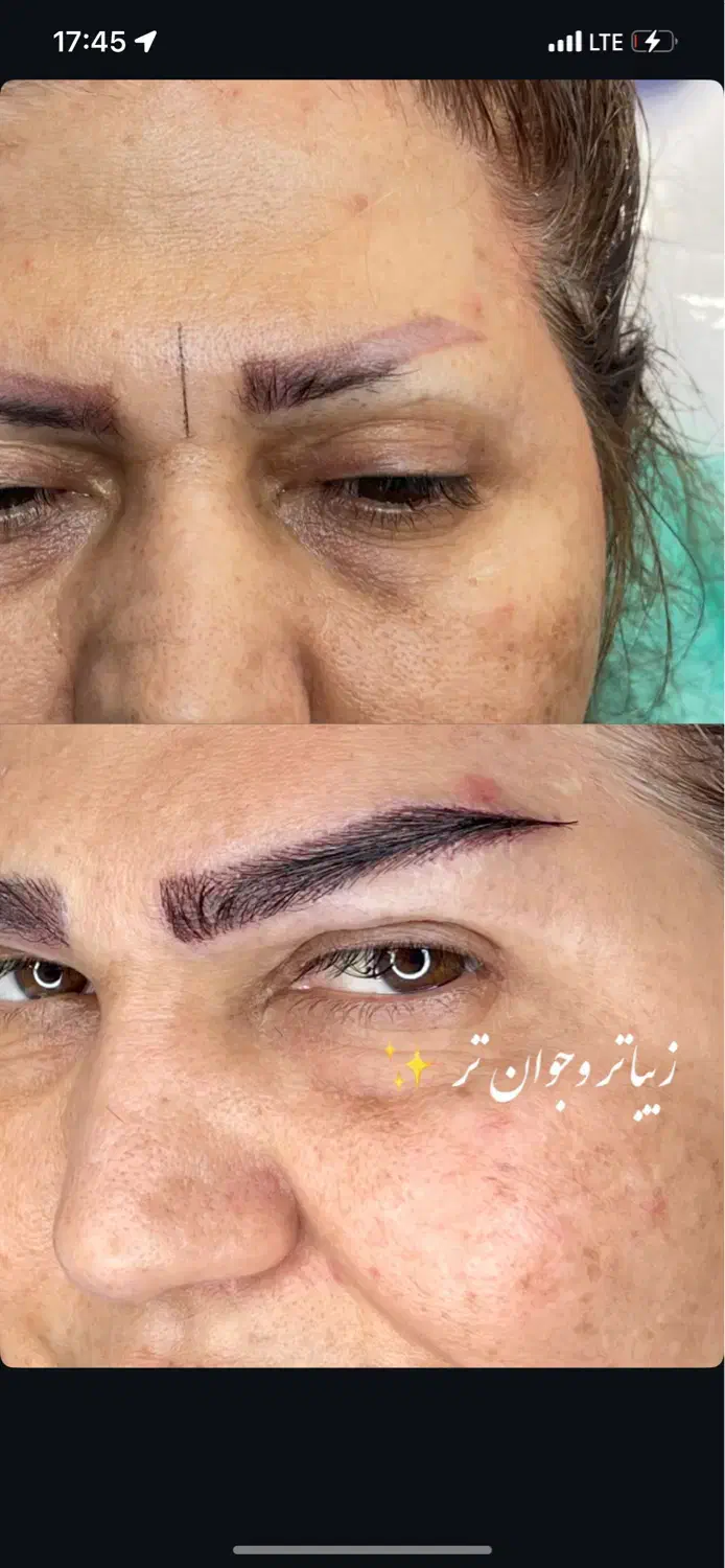 «کاشت ابرو طبیعی در بوشهر تیم پزشکی مجرب|خدمات آرایشگری و زیبایی|بوشهر, |دیوار