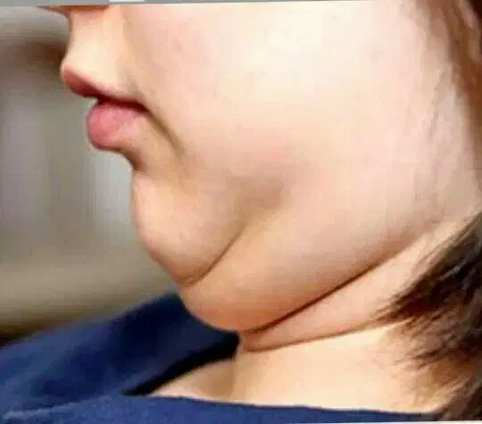 ژل لاغری شکم وپهلو‌وبازو بینی وغبغب اصل|آرایشی، بهداشتی، درمانی|اسلام‌‌آباد غرب, |دیوار